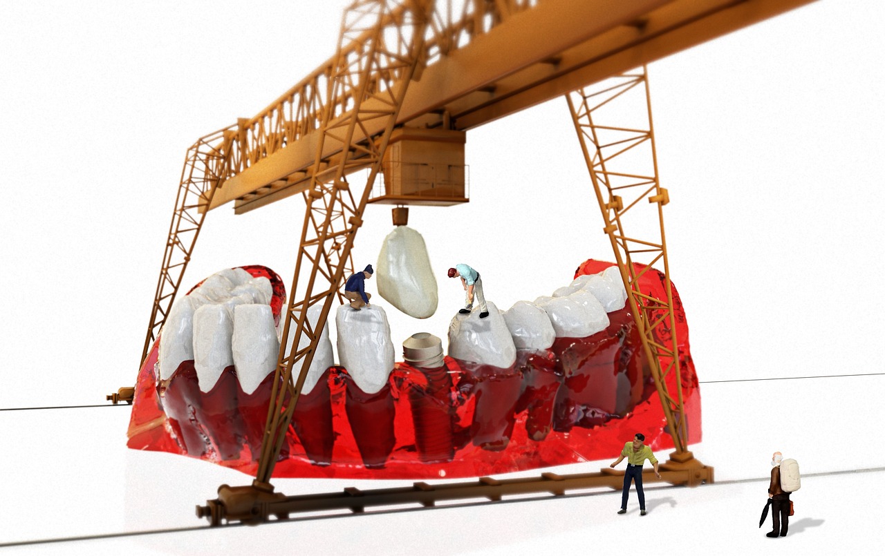 dentist, crown, miniature figures, orthodontist, dental care, teeth, jaw, crane, repair, implant, tooth loss, oral surgeon, work, dentures, tooth, 3d model, tiny, modelling, miniature figure, small, creative, toy figure, model construction figure, lüttje, nerve pain, dentist, dentist, implant, implant, implant, implant, implant, tooth